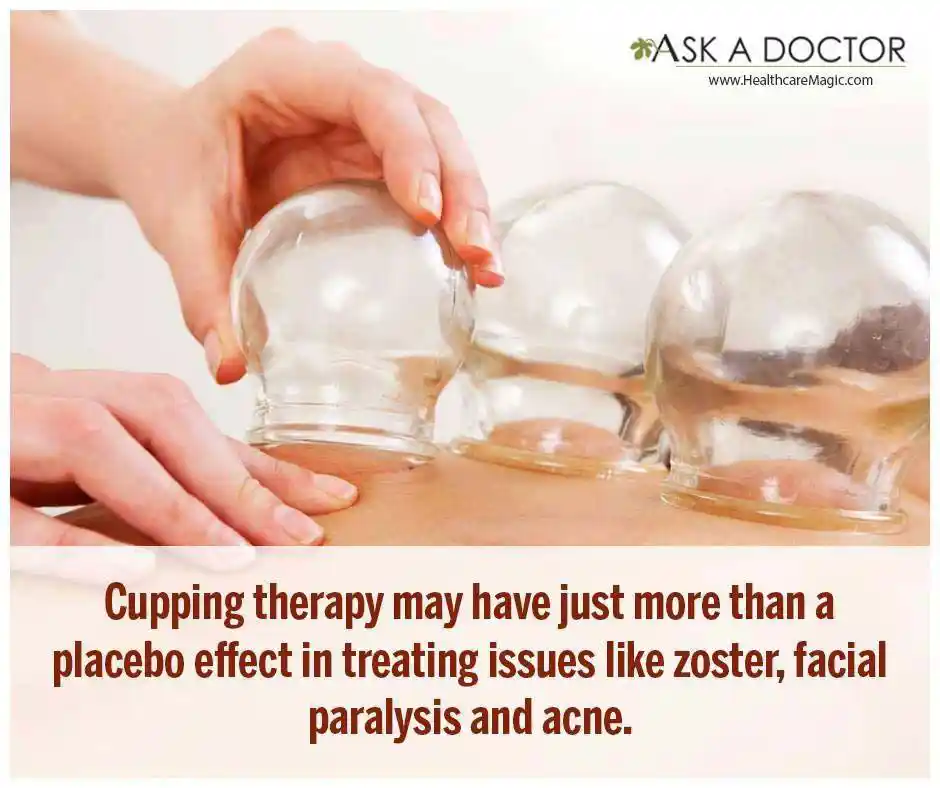 Have You Heard About Facial Cupping - Know the Benefits, Method, and Precautions
