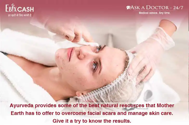 What Ayurveda Suggests For Treating Facial Scars?