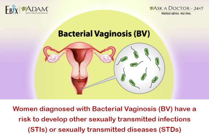 What Is Bacterial Vaginosis And Its STD Connection: Know The Facts.