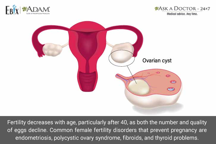 Can Ovarian Cysts Affect Your Chances of Getting Pregnant? Know the Facts