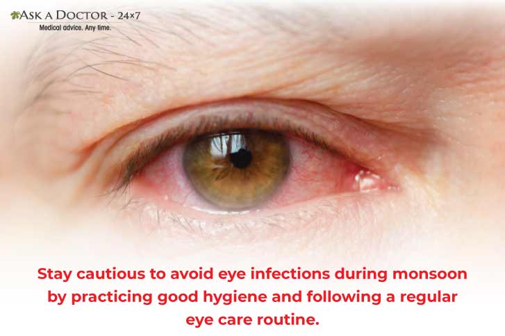 7 Functional Remedies to Tackle Eye Infections And Flu During The Monsoon Season