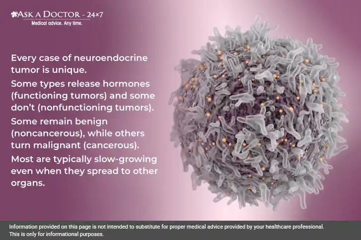 7 Things to Know About Neuroendocrine Tumors