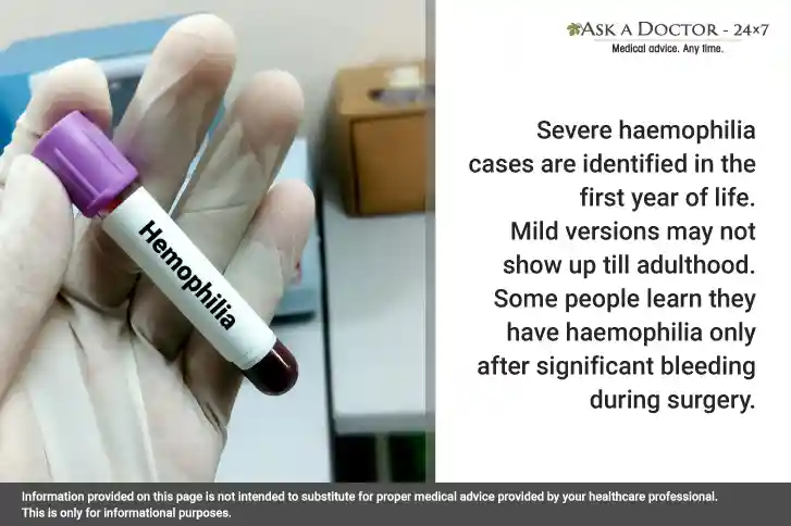 If You Get Bruised Easily, You Must Learn About Haemophilia B