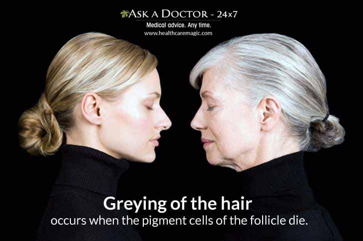 Truth or Myth: Pulling Out A Gray Hair Increases Gray Hair Growth ! | Truth  Or Myth | Ask a Doctor 24x7